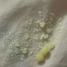 Mèo cái tiểu được khi sỏi struvite kích thước bao nhiêu?